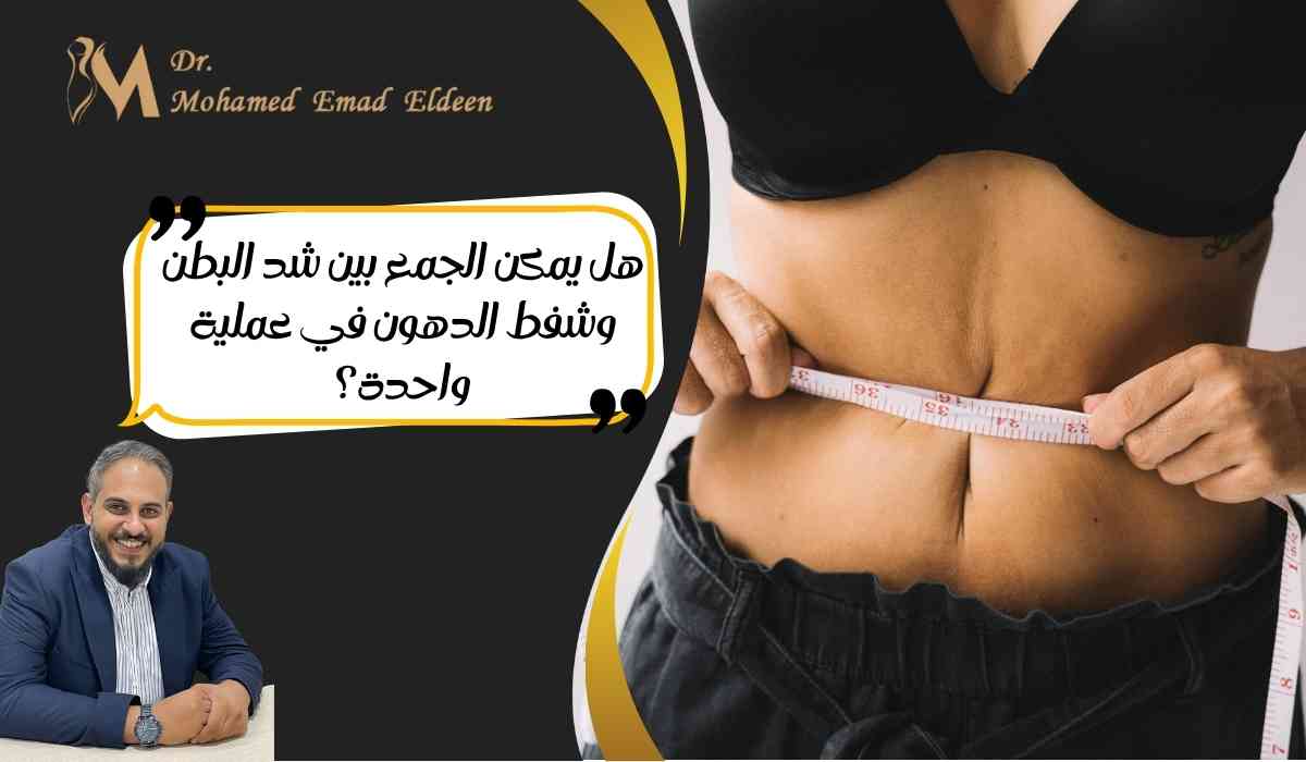 عملية-شد-البطن-وشفط-الدهون