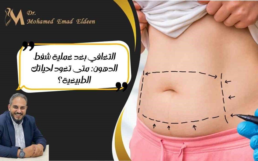 التعافي بعد عملية شفط الدهون: متى تعود لحياتك الطبيعية؟