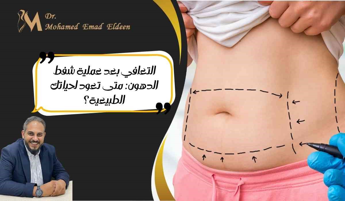 التعافي بعد عملية شفط الدهون: متى تعود لحياتك الطبيعية؟