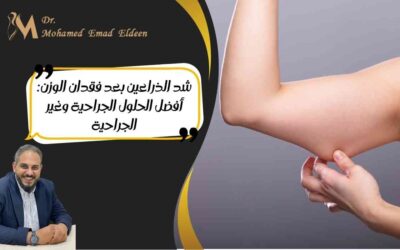 شد الذراعين بعد فقدان الوزن: أفضل الحلول الجراحية وغير الجراحية
