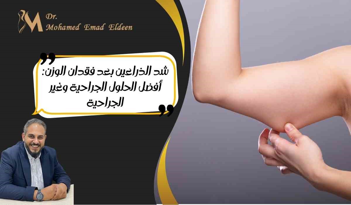 شد الذراعين بعد فقدان الوزن: أفضل الحلول الجراحية وغير الجراحية شد الذراعين بعد فقدان الوزن: أفضل الحلول الجراحية وغير الجراحية