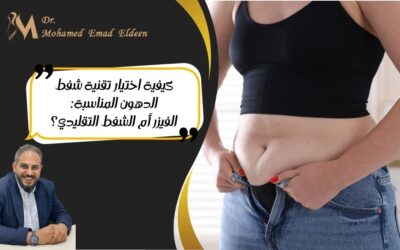 كيفية اختيار تقنية شفط الدهون المناسبة: الفيزر أم الشفط التقليدي؟