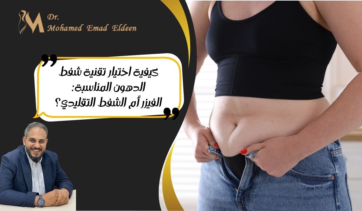 كيفية اختيار تقنية شفط الدهون المناسبة: الفيزر أم الشفط التقليدي؟ كيفية اختيار تقنية شفط الدهون المناسبة: الفيزر أم الشفط التقليدي؟
