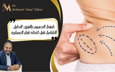 شفط الدهون بالفيزر: الدليل الشامل قبل اتخاذ قرار العملية