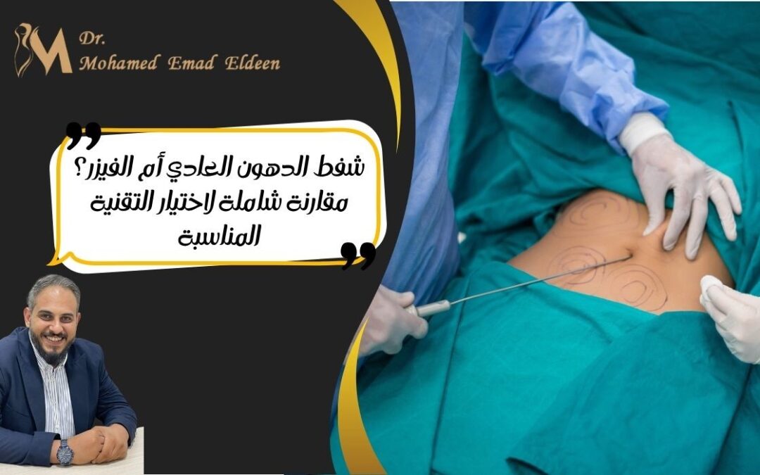 شفط الدهون العادي أم الفيزر؟ مقارنة شاملة لاختيار التقنية المناسبة