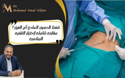 شفط الدهون العادي أم الفيزر؟ مقارنة شاملة لاختيار التقنية المناسبة