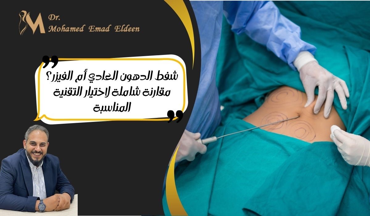 شفط الدهون العادي والفيزر شفط الدهون العادي والفيزر