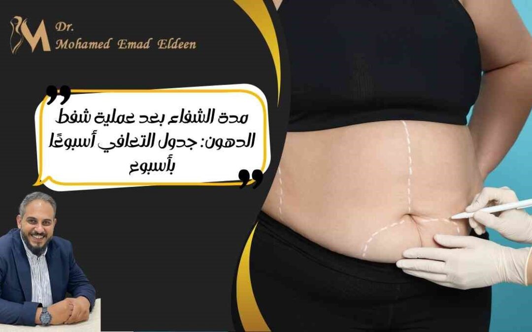 مدة الشفاء بعد عملية شفط الدهون: جدول التعافي أسبوعًا بأسبوع