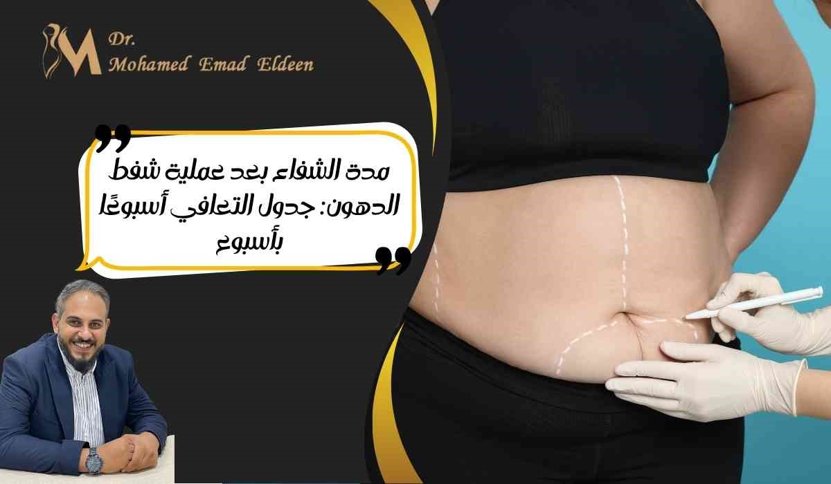 مدة الشفاء بعد عملية شفط الدهون: جدول التعافي أسبوعًا بأسبوع