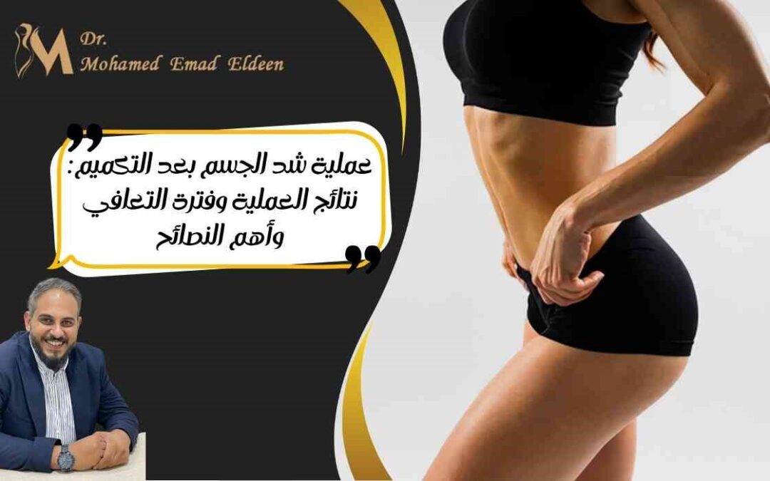 عملية شد الجسم بعد التكميم: نتائج العملية وفترة التعافي وأهم النصائح