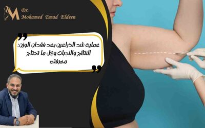 عملية شد الذراعين بعد فقدان الوزن: النتائج والندبات وكل ما تحتاج معرفته
