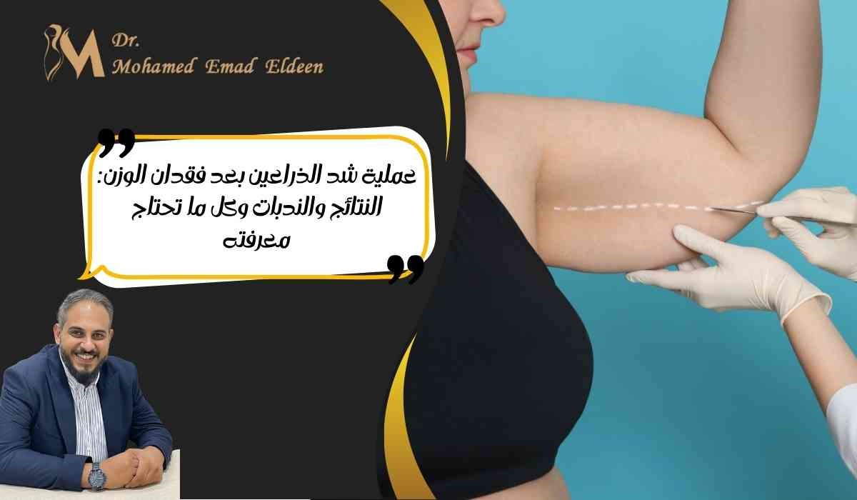 عملية شد الذراعين بعد فقدان الوزن: النتائج والندبات وكل ما تحتاج معرفته عملية شد الذراعين بعد فقدان الوزن: النتائج والندبات وكل ما تحتاج معرفته
