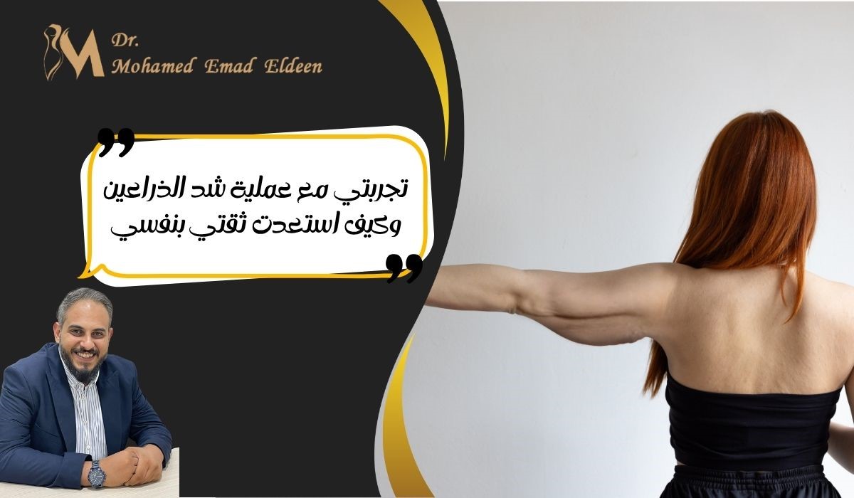 تجربتي مع عملية شد الذراعين وكيف استعدت ثقتي بنفسي تجربتي مع عملية شد الذراعين وكيف استعدت ثقتي بنفسي