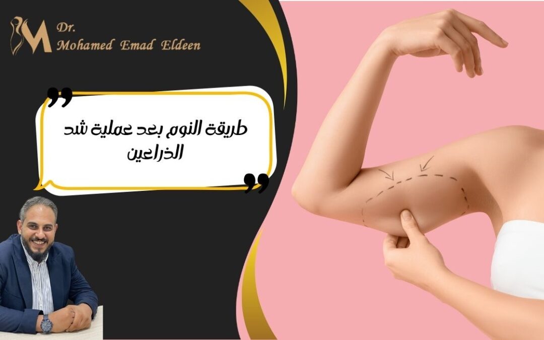 طريقة النوم بعد عملية شد الذراعين