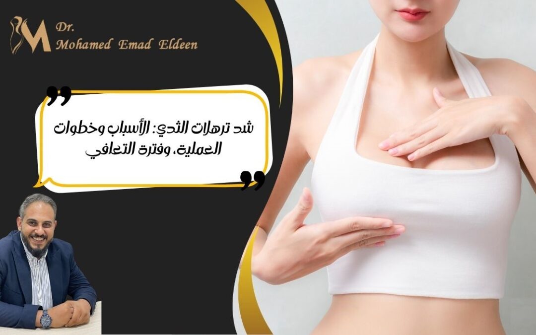 شد ترهلات الثدي: الأسباب وخطوات العملية، وفترة التعافي