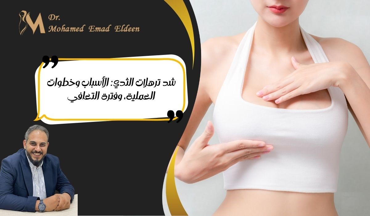 شد ترهلات الثدي: الأسباب وخطوات العملية، وفترة التعافي شد ترهلات الثدي: الأسباب وخطوات العملية، وفترة التعافي