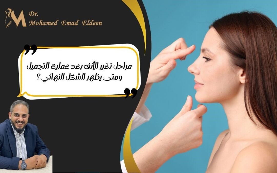 مراحل تغير الانف بعد عملية التجميل​ ومتى يظهر الشكل النهائي؟