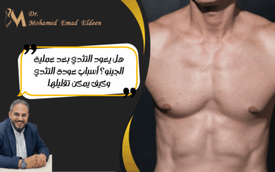 هل يعود التثدي بعد عملية الجينو؟ أسباب عودة التثدي وكيف يمكن تقليلها