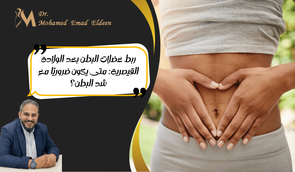 ربط عضلات البطن بعد الولادة القيصرية ربط عضلات البطن بعد الولادة القيصرية